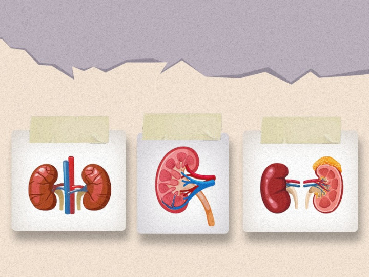 Efek Samping dengan Satu Ginjal