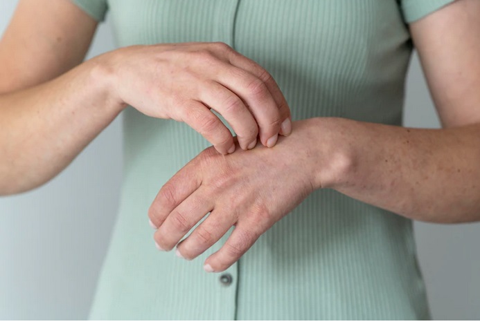 Kenali Gejala Dermatillomania, Kebiasaan Mencabut Kulit