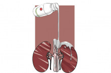 Lorong Gelap Obat Sirop Maut