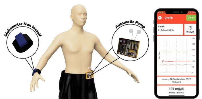 3 Mahasiswa UB Ciptakan Glukosipp, Pengendali Gula Darah