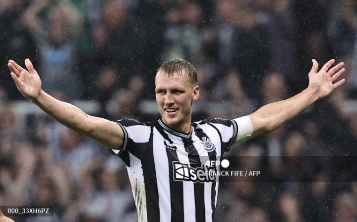 Newcastle Perpanjang Kontrak Burn