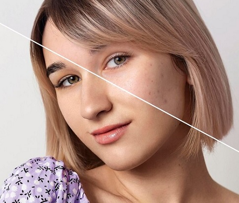 Serum untuk memperbaiki skin barrier. (Foto: Dok. DexSkin)