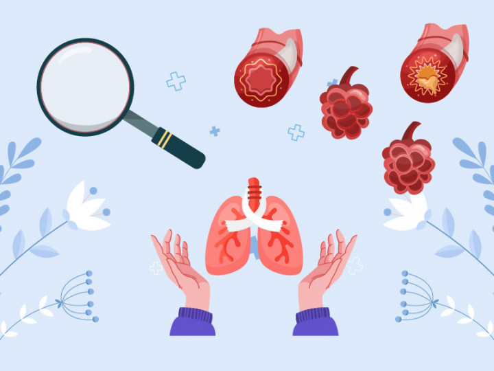 Apa itu Kanker Paru-paru?