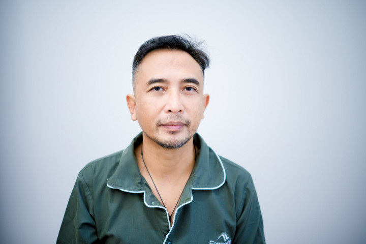 Piyu Padi Transplantasi Rambut, Dokter Kaget Temukan Fakta Ini