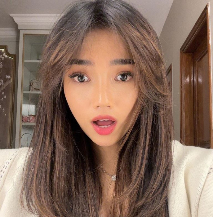 Kenali Gejala dan Penyebab ADHD yang Diidap Fuji