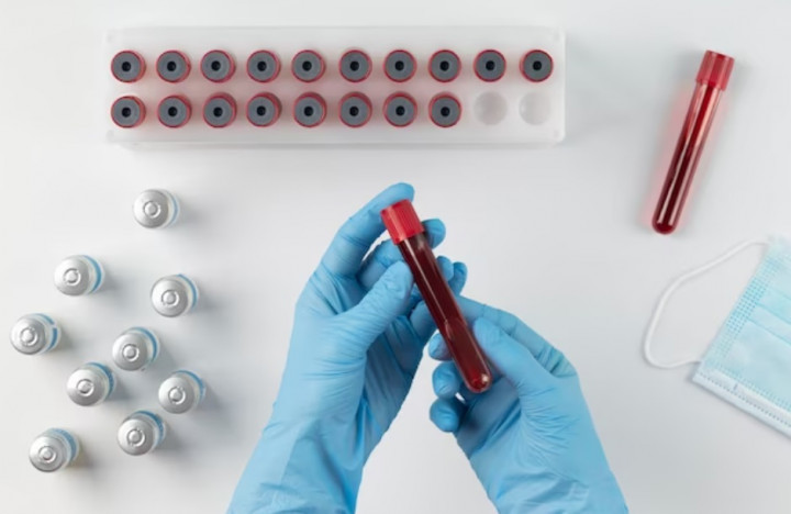 Heboh! Dokter di Tiongkok Temukan Golongan Darah Subtipe P, Apa Itu?