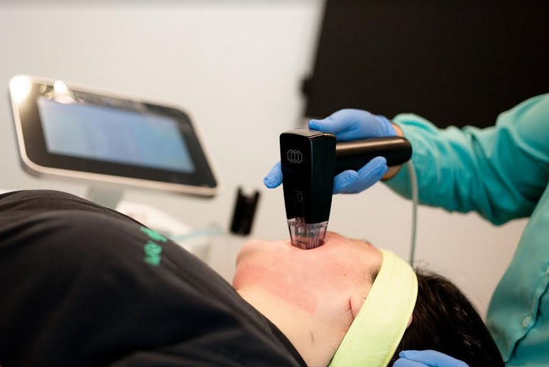 ollagen Stimulation Therapy adalah suatu tindakan yang menggabungkan teknologi microneedling dan fractional radiofrequency (RF) untuk peremajaan dan pengencangan kulit. Dok. RSPI