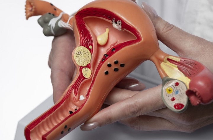 Wamenkes sebut Skrining Kanker Serviks Modal Utama Tanggulangi Kematian Perempuan