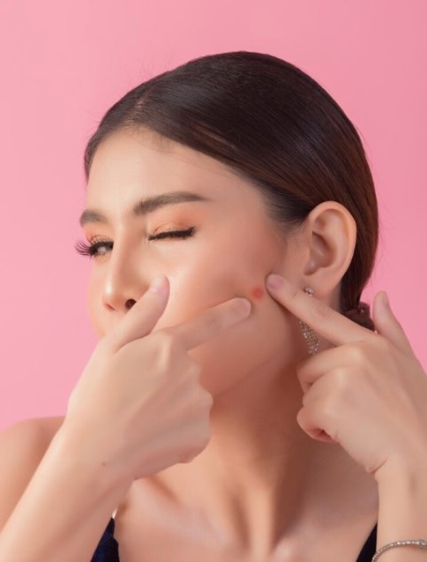 5 Masalah Umum Pada Kulit yang Sering Timbul di Musim Hujan