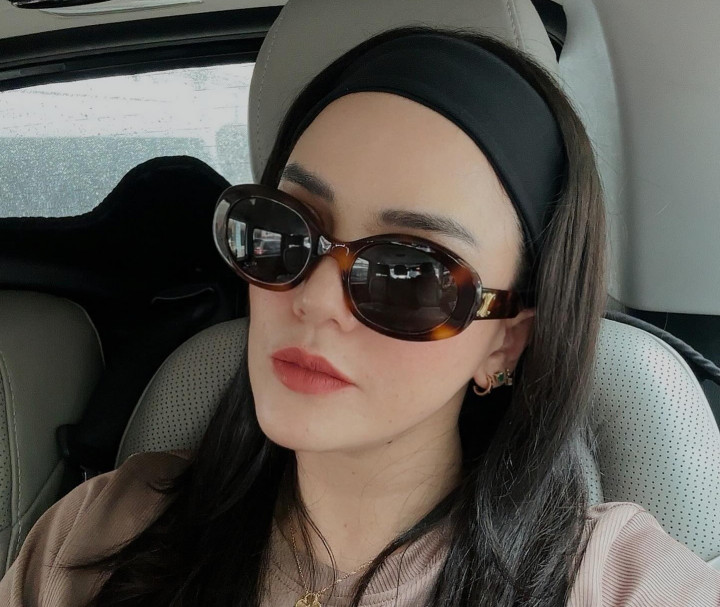 Kondisi Alice Norin Usai Jalani Operasi Kanker Sarkoma