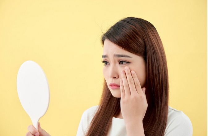 Ketahui Cara Memilih Skincare untuk Kulit Berminyak dan Berjerawat