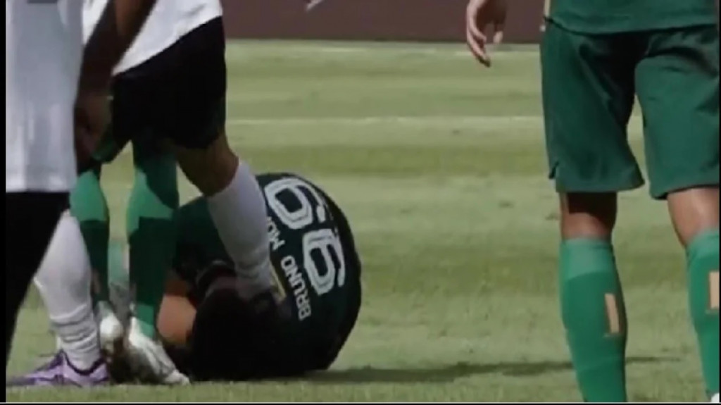 Pemain PSS Sleman, Wahyudi Hamisi, menendang kepala pemain Persebaya Surabaya, Bruno Moreira (tangkapan layar Instagram Persebaya)