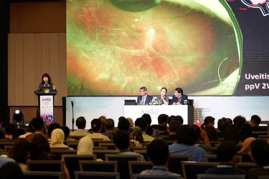 Asia Pacific Academy of Ophthalmology Congress 2024 digelar di Bali Nusa Dua Convention Center pada 22-25 Februari.  Dok. Ist