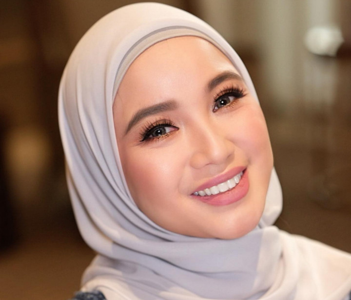 Kesepian Usai Jadi Istri Bupati, Chacha Frederica Minta Bantuan Psikolog