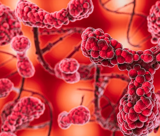 Multiple myeloma adalah salah satu jenis kanker darah yang menyerang sel plasma. (Foto: Ilustrasi. Dok. Freepik.com)