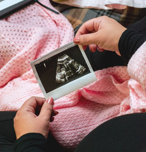 Hamil Anggur, Wajib Tahu tentang Komplikasi Kehamilan yang Jarang Terjadi Ini