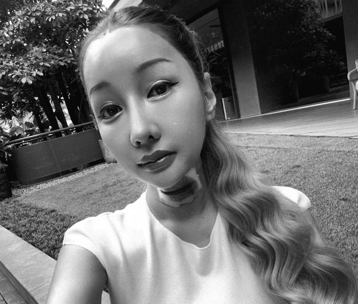 Operasi Pita Suara, Lucinta Luna Minta Mirip Agnez Mo