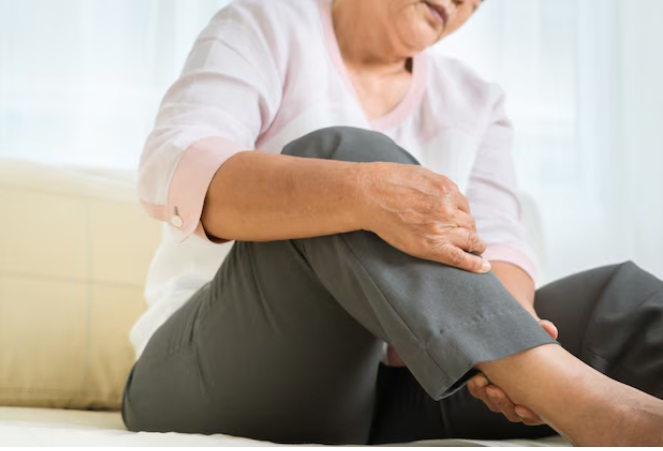 Sering Dianggap Sepele, Varises Bisa Menurunkan Kepercayaan Diri Penderitanya