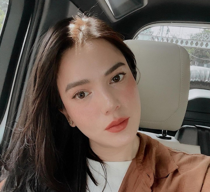 Idap Kanker Sarkoma, Hidup Alice Norin Berubah Jad Begini