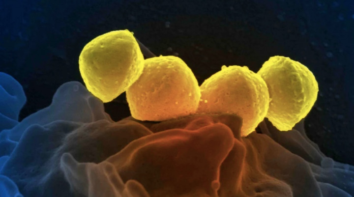 Jepang Lapor Lonjakan Kasus Bakteri Pemakan Daging