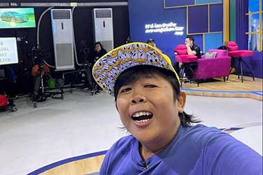 Adul Beberkan Masalah pada Matanya