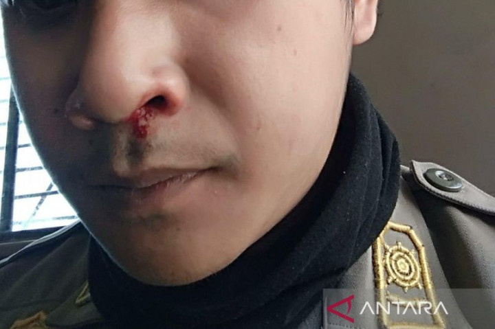 Anggota Satpol PP Kabupaten Bogor Terluka Dianiaya PKL di Puncak