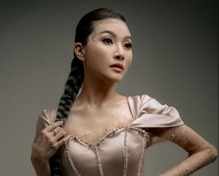 Sarwendah Tanggapi Netizen yang Cibir Hasil Operasi Plastiknya