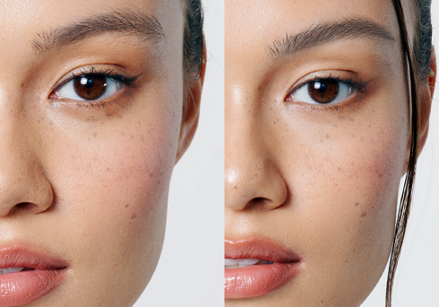 Foto kiri sebelum dan kanan setelah menggunakan Secondate Brow Updo Crystal Clear Browcara. (Foto: Dok. Istimewa)