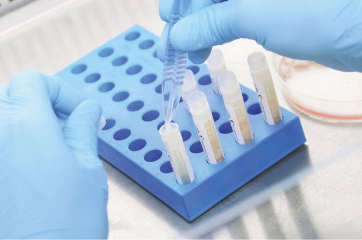 Memiliki Kandungan Stem Cell, Tali Pusat Berfungsi untuk Pengobatan di Masa Depan