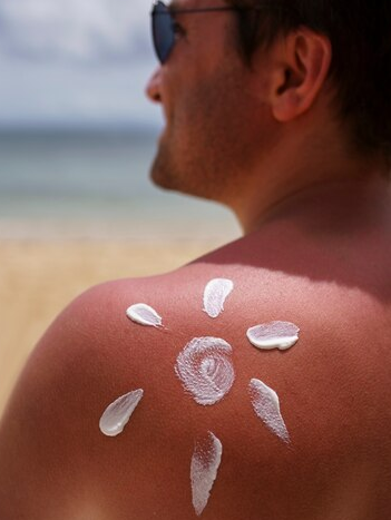 Kenali Bedanya Keracunan Sinar Matahari dan Ruam Panas