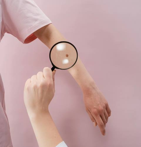 Tidak Seperti Covid-19, Mpox Bukanlah Penyakit Baru dan Dapat Dihentikan