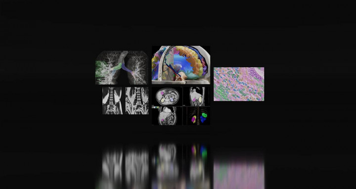 Pusat Medis Pakai AI untuk Belajar Deteksi Kanker Lebih Baik