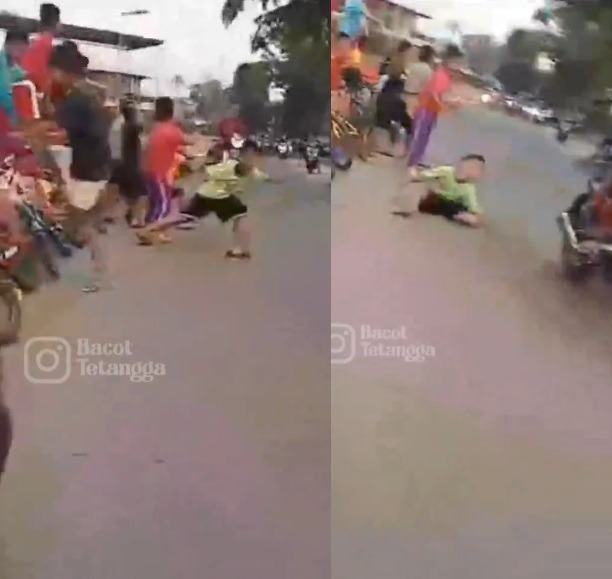 Viral Bocah Tertabrak Motor saat Berburu Klakson Telolet hingga Alami Cedera Serius