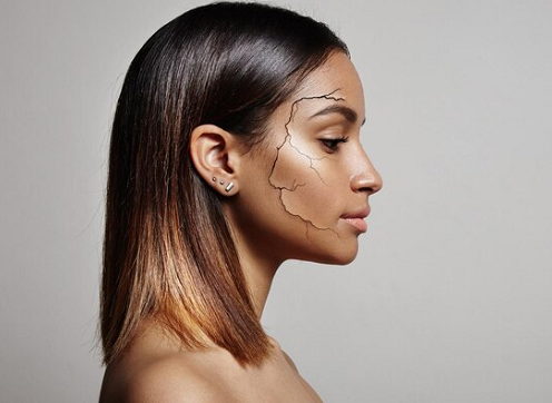 6 Cara Mengatasi Kulit Kering dan Bersisik, Pakai Sabun Khusus hingga Konsumsi Vitamin