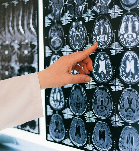 Benarkah Minuman Ini Bisa Tingkatkan Risiko Stroke?