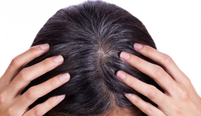 8 Penyebab Munculnya Uban di Usia Muda dan Cara Mencegahnya