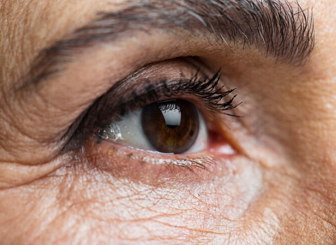 Glaukoma Sebabkan Buta Permanen! Ketahui Gejala dan Pengobatan yang Tepat