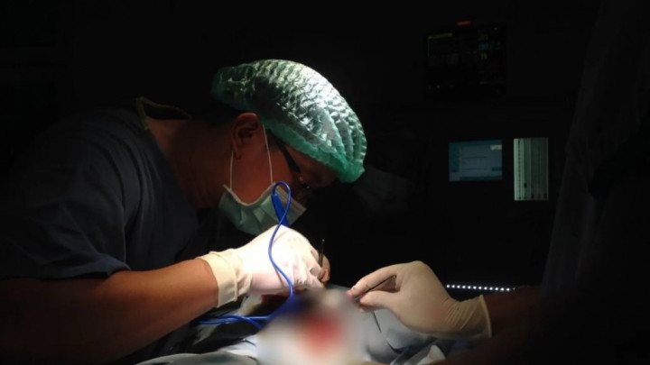 Semakin Canggih, Menangani Wasir dengan Teknologi Laser tanpa Rasa Sakit