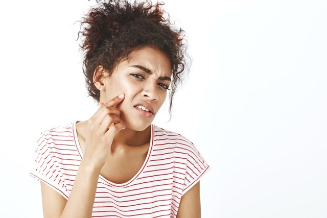Dermatitis perioral dapat berlangsung selama berbulan-bulan hingga beberapa tahun. (Foto: Ilustrasi/Dok. Freepik.com)