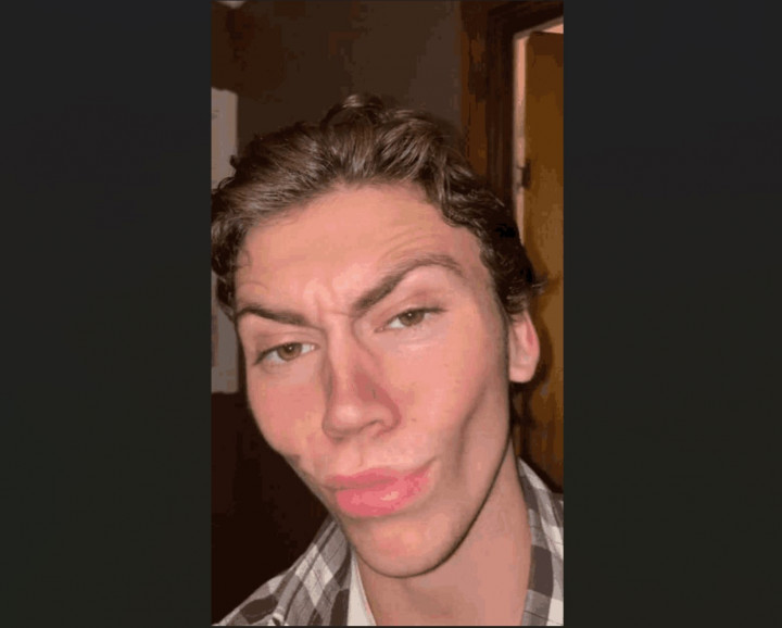 Benarkah 'Mewing' Bisa Bikin Dagu dan Rahang Lebih Tajam? Ini Faktanya