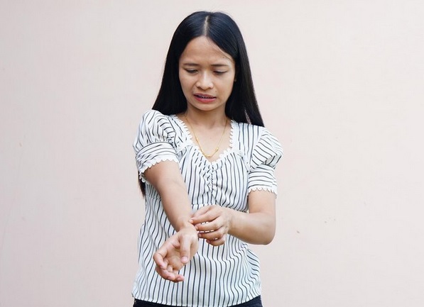 Gejala umum biduran adalah terdapat bintil, gatal, dan bila digaruk dapat menyebabkan luka. Ilustrasi Freepik