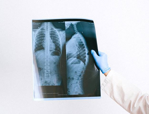 WHO Tetapkan TB Penyakit Menular Paling Mematikan