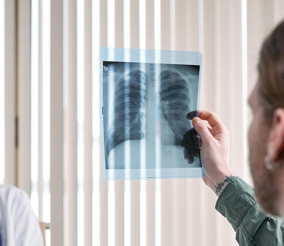 Ini Perbedaan Pneumonia yang Dialami Anak-anak dan Orang Dewasa