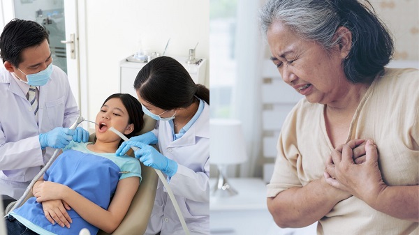 Gigi Berlubang Picu Serangan Jantung, Mitos atau Fakta?