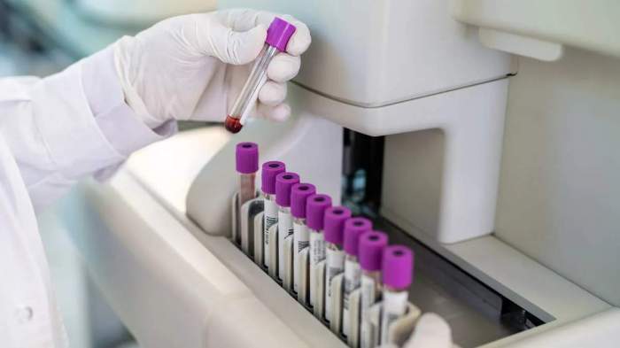 Ratusan Sampel Virus Mematikan Hilang dari Laboratorium Australia