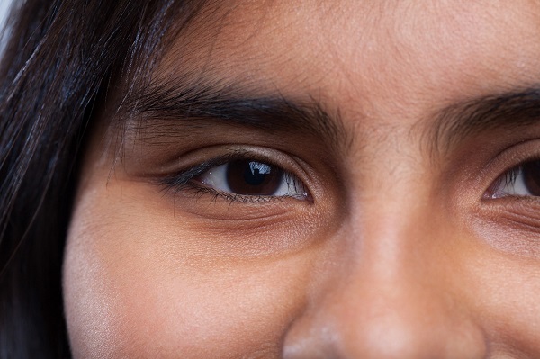 6 Cara Efektif Mengatasi 'Mata Panda'