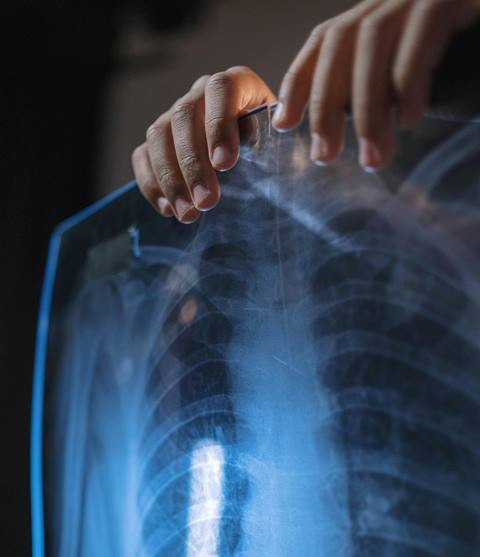 Wamenkes Apresiasi Peran Kader dalam Program TOSS TB