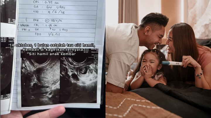 Siti Badriah Hamil Anak Kembar, tapi Satu Janin Harus Diangkat demi Selamatkan Nyawa