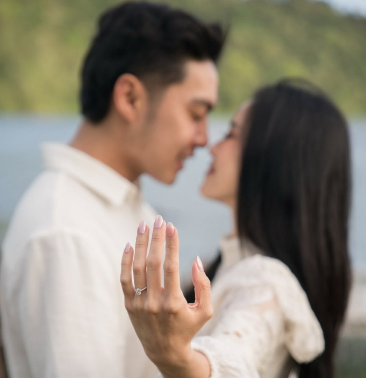 Jessica Jane dan Erwin Phang Bagikan Momen Lamaran Romantis
