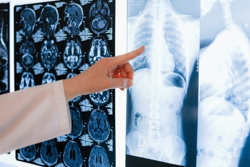 Mencegah Virus Pernapasan Melalui Vaksinasi dan Edukasi (Foto: freepik)